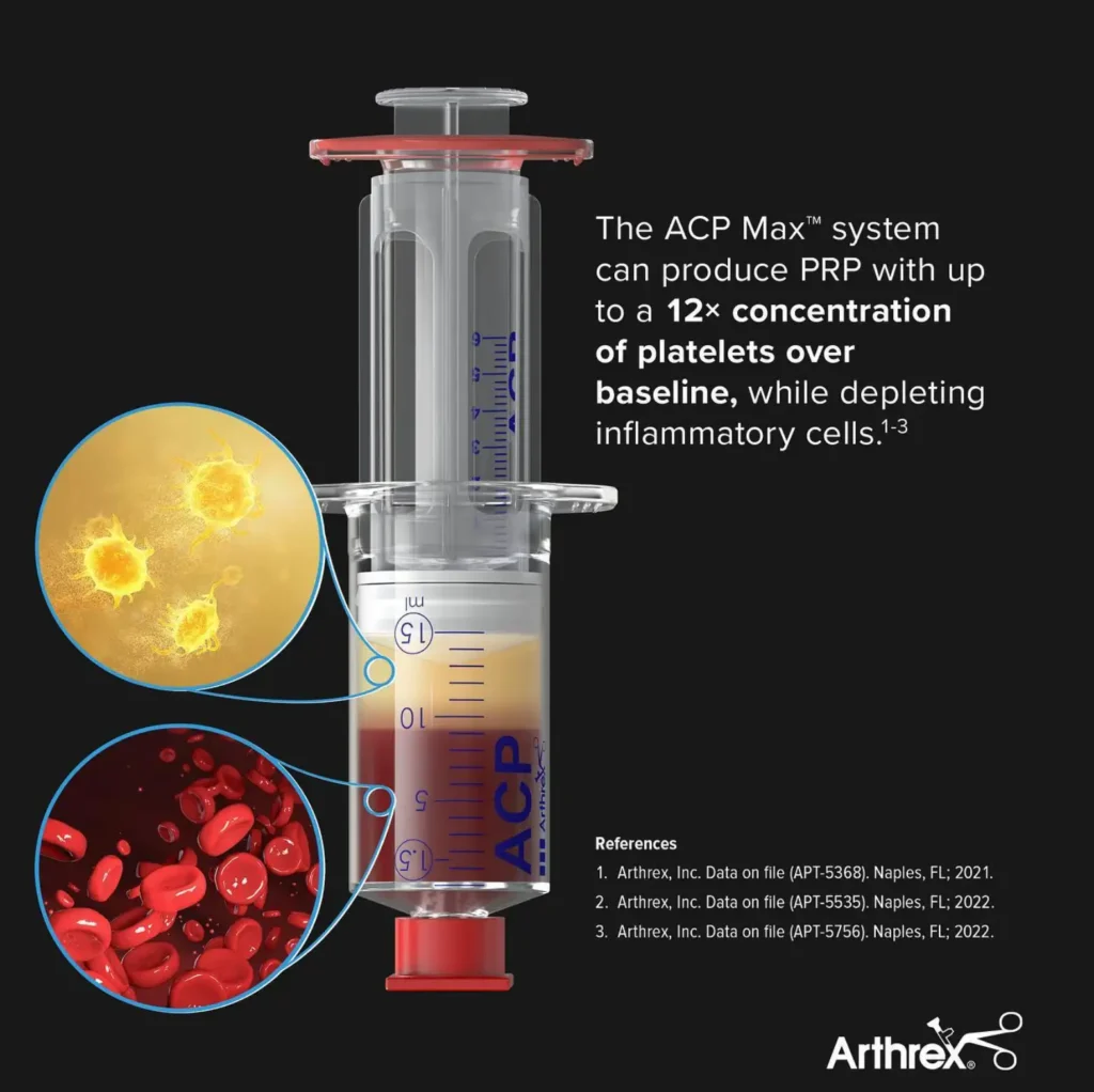 The ACP Max™ system